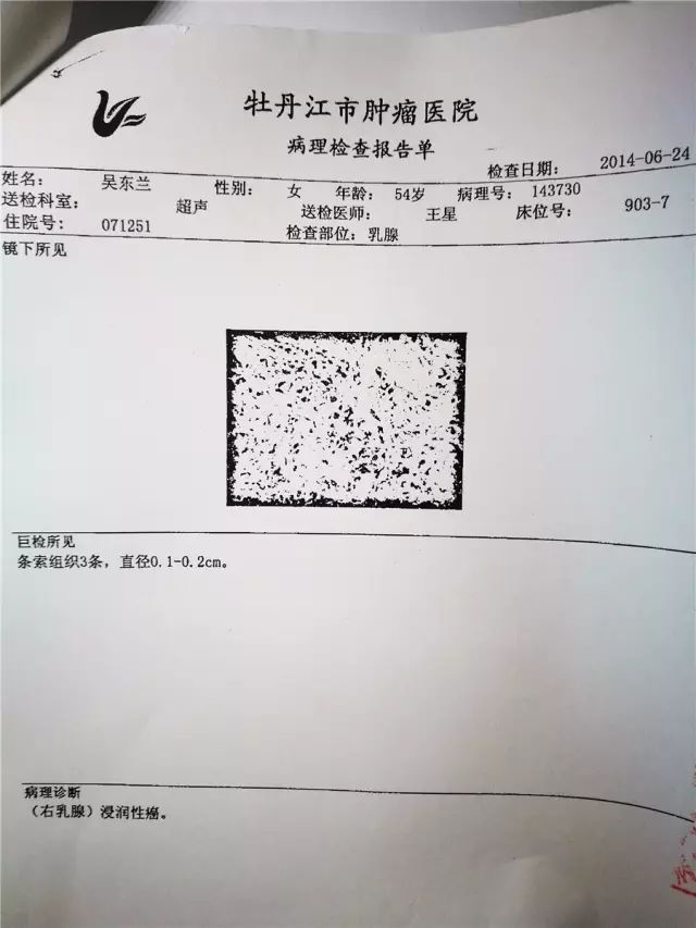 我沒做過什麼壞事，為什麼會得乳腺癌